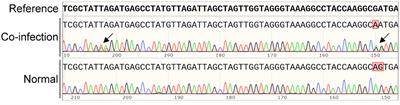 Co-existence of Multiple Anaplasma Species and Variants in Ticks Feeding on Hedgehogs or Cattle Poses Potential Threats of Anaplasmosis to Humans and Livestock in Eastern China